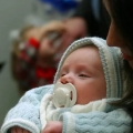 Кожа новорожденного ребенка: физиологическая норма (шелушится, сухая,красная) и патология (высыпания, опрелости)